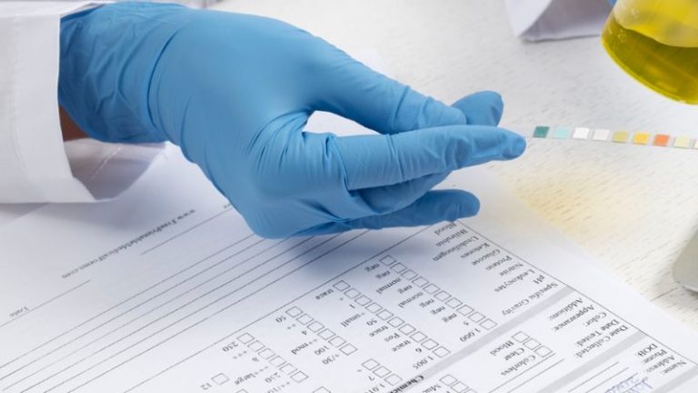 Exame toxicológico obrigatório: dados comprovam impacto na redução de acidentes e ampliam debate sobre jovens condutores